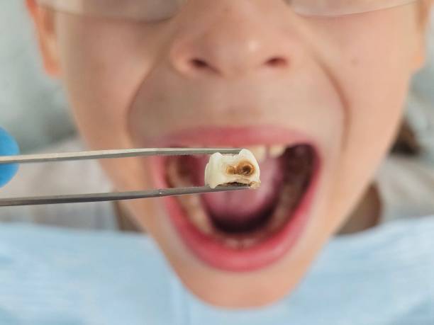 Best Emergency Dental Care for Trauma or Injury in Sharon, PA