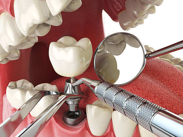 Best Emergency Broken Tooth Repair in Sharon, PA